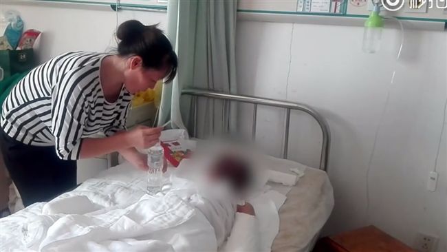 她割皮救子　兒不捨：不要用媽媽的皮