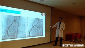 三軍總醫院心臟內科主治醫師蔡維哲提醒，預防冠心症平日飲食應少油少鹽、多吃蔬果、規律運動等，避免抽菸。（圖／記者楊晴雯攝）