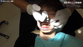 網紅將冷光美白的過程放上網。（圖／翻攝自放火 Louis臉書）