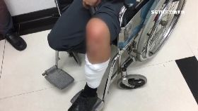 d演習炸傷腿1600