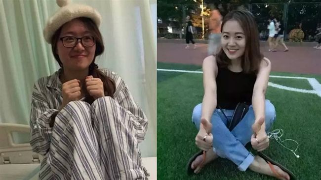 女博士罹漸凍症　遺言「能捐的都捐」