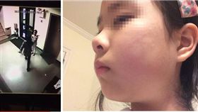 暴力,賀卡,鄰居,巴掌,美國,紐約,傷害罪