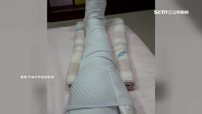 美魔女議員被車撞　右膝骨折需休兩月