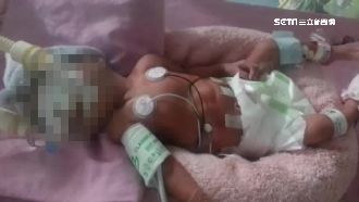 懷孕7月大出血　婆婆一席話暖哭孕婦