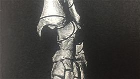 林男遭「斧刃腳」攻擊導致腓骨斷裂腳踝脫臼。（圖／翻攝畫面）