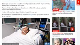 英國,博赫斯,Andrew Broadhurst,中耳炎,誤診,腦死(太陽報 https://www.thesun.co.uk/news/4757943/andrew-broadhurst-killed-meningitis-ear-infection-gp-inquest/)