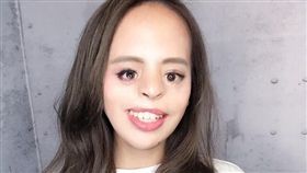 ▲曾宇辰是唇顎裂患者。（圖／翻攝自臉書）