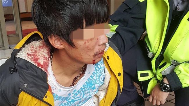 不爽大叔偷看女友　男找友談判反遭砍