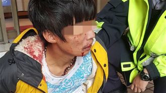 不爽大叔偷看女友　男找友談判反遭砍