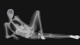 私密照,情趣,裸照,女友,情侶,護理師,爆笑公社,廣告,X光機
https://www.facebook.com/permalink.php?story_fbid=564885860528570&id=162608724089621