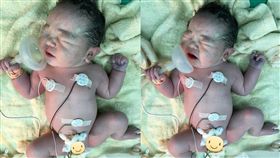 先天心臟病女嬰出生緊抓氧氣罩　「我會照顧好自己！」

台大醫院婦產科主治醫師施景中臉書