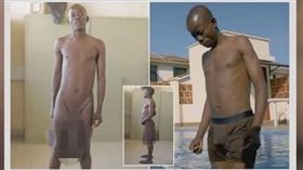 肯亞基比戈里鎮有一名20歲男子歐皮尤（Horace Owiti Opiyo），因為他的命根子被蚊子叮到，導致他的陰莖長91公分、睾丸重約5 公斤，經過兩次「縮陽」手術後才恢復正常（圖／翻攝自YouTube《Showbiz News Channel》）