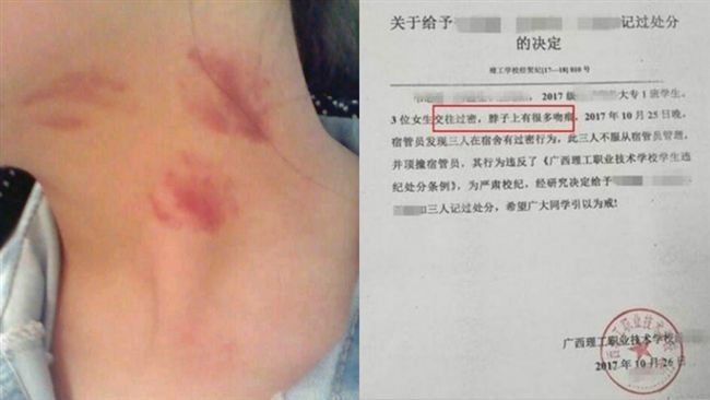 管太多？3女學生互種草莓遭記過處分