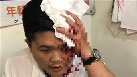 里長許政鎧遭崔男持玻璃菸灰缸砸破頭。（圖／翻攝畫面）