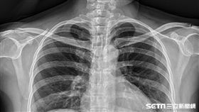 性交易遇警突襲　按摩女急吞保險套