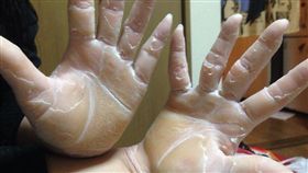 16:9
火雲掌是真的！新北水電師傅　雙手竟不怕高溫、火燒
掌蹠角化症
圖／翻攝自gackemo_n Twitter
https://twitter.com/gackemo_n/status/574244070534483968