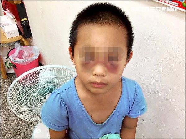 「真的想扁他」變態虐女童惹怒眾檢警