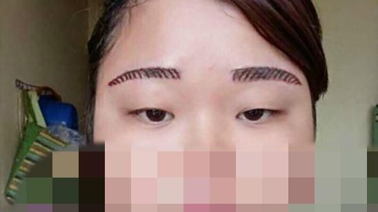 她花千元霧眉　竟成「住院縫針眉」