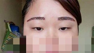 她花千元霧眉　竟成「住院縫針眉」