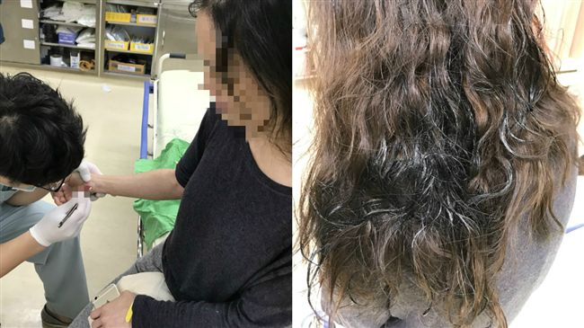 女空服員遭潑瀝青　手部灼傷見血