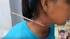 坐在箭靶旁休息　印度14歲少女遭同學一箭射穿頸...（圖／翻攝自Sangbad Pratidin YouTube） 