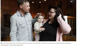 美國,明尼蘇達州,人妻,捐贈 器官
https://www.theguardian.com/us-news/2017/nov/10/your-gift-will-not-be-wasted-face-transplant-patient-meets-donors-widow