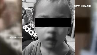 4歲童疑遭虐打流血　生母居然搞失蹤
