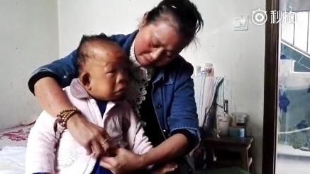 慈母苦養30歲病兒　盼他開口叫聲媽