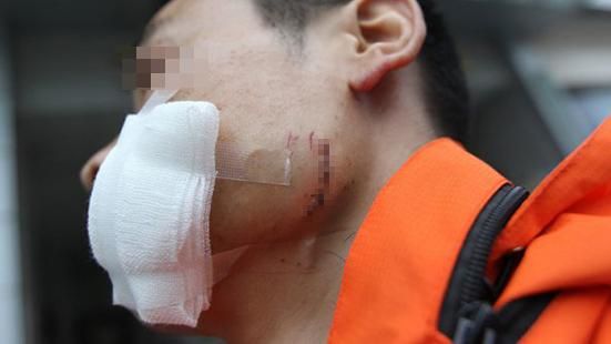不滿送貨打擾　她拿啤酒瓶爆擊快遞頭