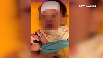 女童疑顱內出血　保母遭控未立即送醫