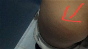 體罰學生　校長遭記申誡處分台南市今年5月傳出有國小校長體罰學生，台南市議員林燕祝15日出示一張學童屁股有藤條傷痕的相片，要求調查清楚。台南市政府教育局證實已對這名校長記一支申誡。（林燕祝提供）中央社記者張榮祥台南傳真　106年11月15日