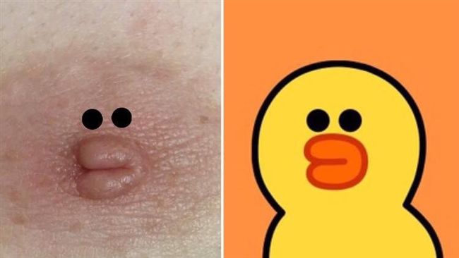 奶頭有明星臉！她出賣男友　網友笑翻
