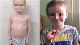 俄羅斯一名男童遭養母虐待不給飯吃，以領取補助金。（圖／翻攝Daily Mail）