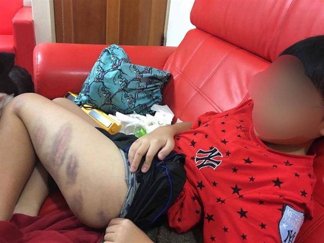 考不到95分！小五男童遭媽「修理」