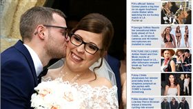 英國,霍爾,Cody Hall,血管瘤,Haemangioma,鬼臉女孩(dailymail http://www.dailymail.co.uk/health/article-5085563/Woman-love-born-deformity.html)