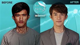 戽斗男滿臉爛痘…整形變成「天菜歐巴」　帥到女人都想倒追 圖翻攝自ig https://www.instagram.com/letmeinth/