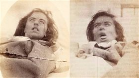 歇斯底里,硝石庫醫院寫真集,hysteria,Jean-Marie Charcot, Salpetriere Hospital,精神病　組合圖／翻攝自每日郵報　https://goo.gl/o6zSeb