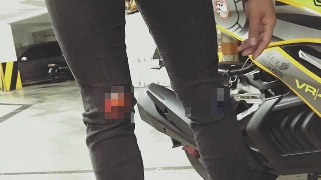 媽媽不懂破褲造型啦　隨手一補網瘋讚