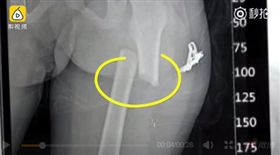 中國大陸,狠父,大腿,走路,腳踹（圖／翻攝自微博）https://www.weibo.com/6004281123/Fwpk81VNt?refer_flag=1001030106_&type=comment