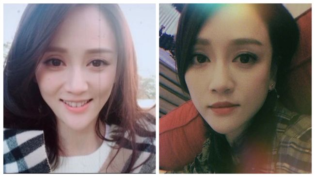 變瘦了？女星自拍照下巴超尖嚇壞網友