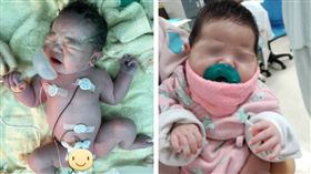 台灣「氧氣罩寶寶」成國際巨星！圓滾滾撒嬌模樣可愛(圖/翻攝自施景中臉書)