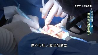 價差超過十倍！僑胞返台最愛看牙科