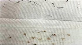 蝨子,陰蝨,寄生蟲,睫毛,眼睛,大陸,大媽,浙江　圖／翻攝自看看新聞