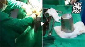 印度,看病,醫生,肚子痛,鋼杯,肛門腔　圖／翻攝自紐約郵報