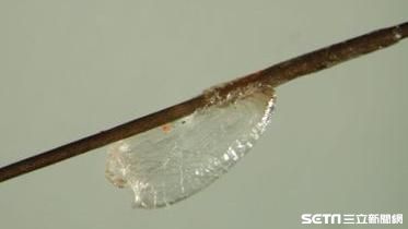 北市校園學童染頭蝨數　國小生拿第一