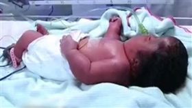 中國大陸,流產,畸形,安胎針,打針,超音波（圖／翻攝自詩華日報）http://news.seehua.com/?p=323948