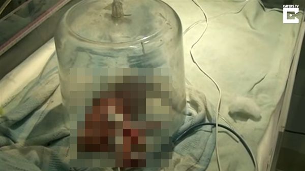 死而復生？男嬰火葬前一刻竟突然呼吸