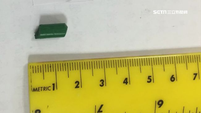 女童哭喊痛就醫　竟在鼻腔取出斷蠟筆