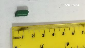 女童哭喊痛就醫　竟在鼻腔取出斷蠟筆