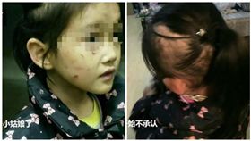中國大陸,湖南,女童遭母親虐待。（圖／翻攝自微博）
